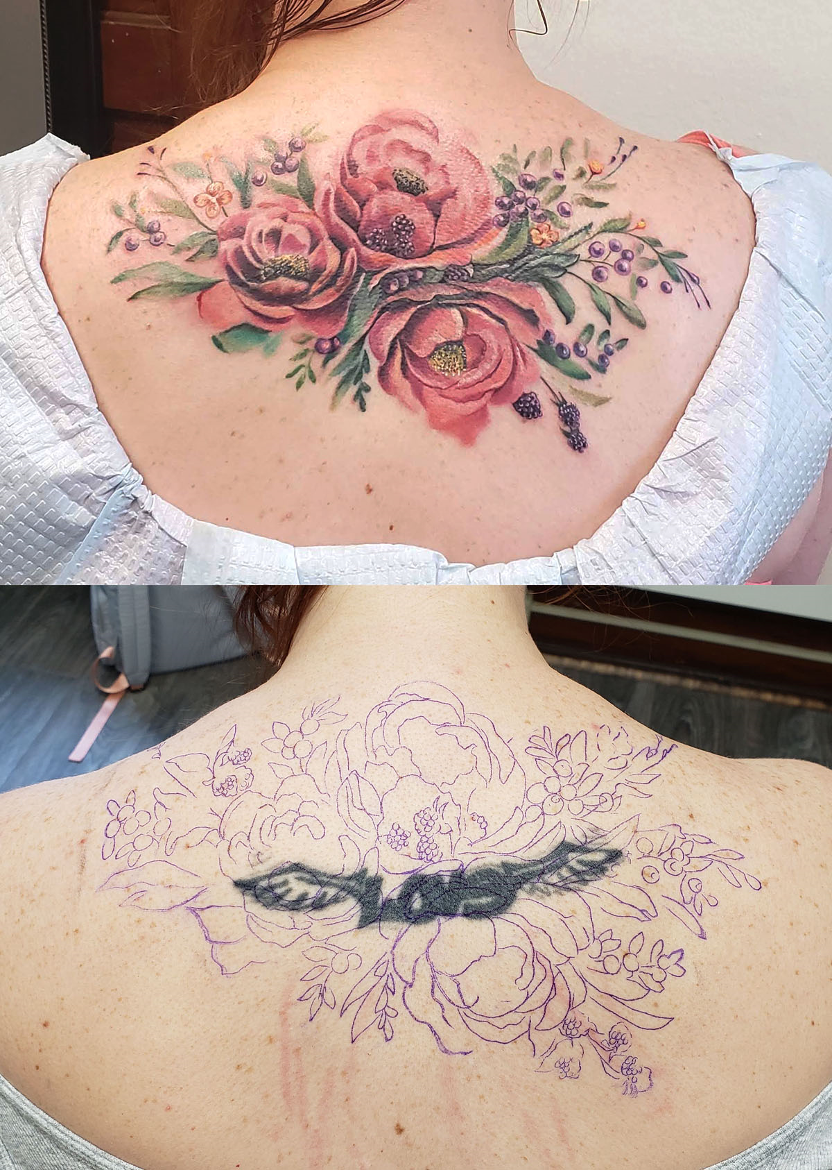 Flower Coverup Before After Tattoo